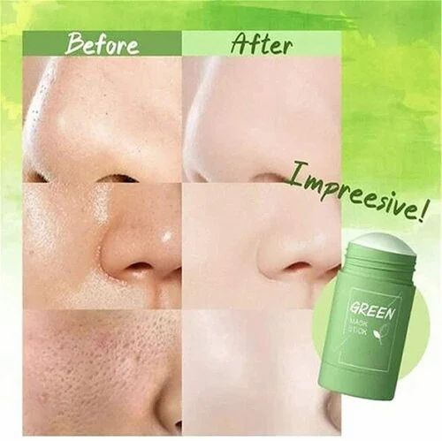 Green Tea Face Mask Stick🌿🌝(BUY 1 GET 1 FREE)